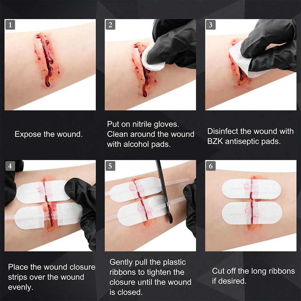 RHINO RESCUE Zip Stitch 6pcs with Wound Dresssings, Wound Closure Strips, Zipstitch Laceration Closure Kit for Cut Care Band-aid